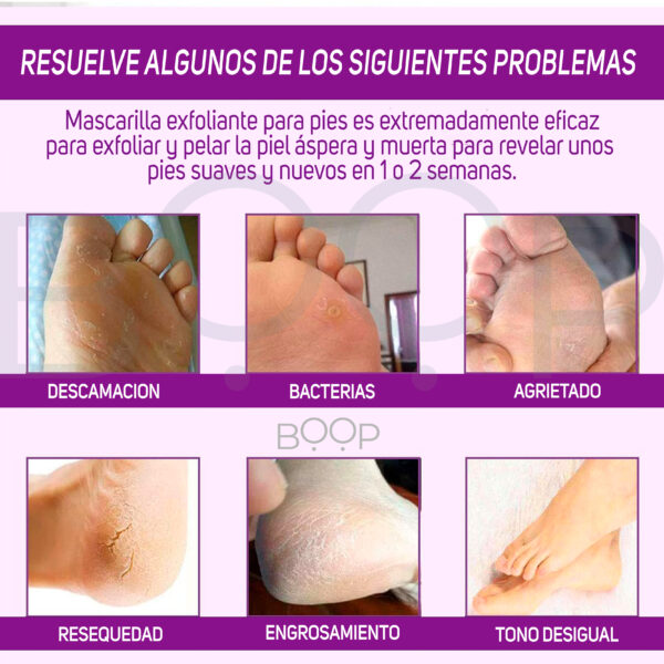 Mascarilla Exfoliante Para Pies Talones Agrietados Aliver - Imagen 3