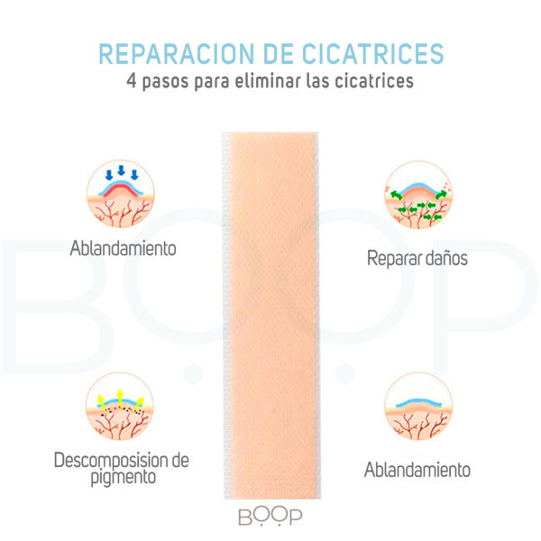 Parche Cinta De Silicona Para Cicatrices Cesarea ALIVER - Imagen 2